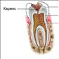 Кариес и его последствия