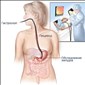 Гастроскопия, эзофагогастродуоденоскопия, фиброгастроскопия (ЭГДС)
